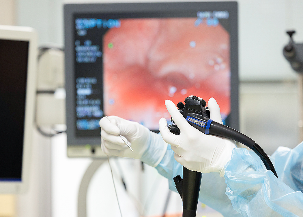 消化管内視鏡検査