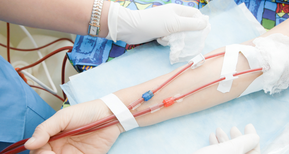 シャント手術や心臓・下肢のカテーテル治療が一括で行える体制